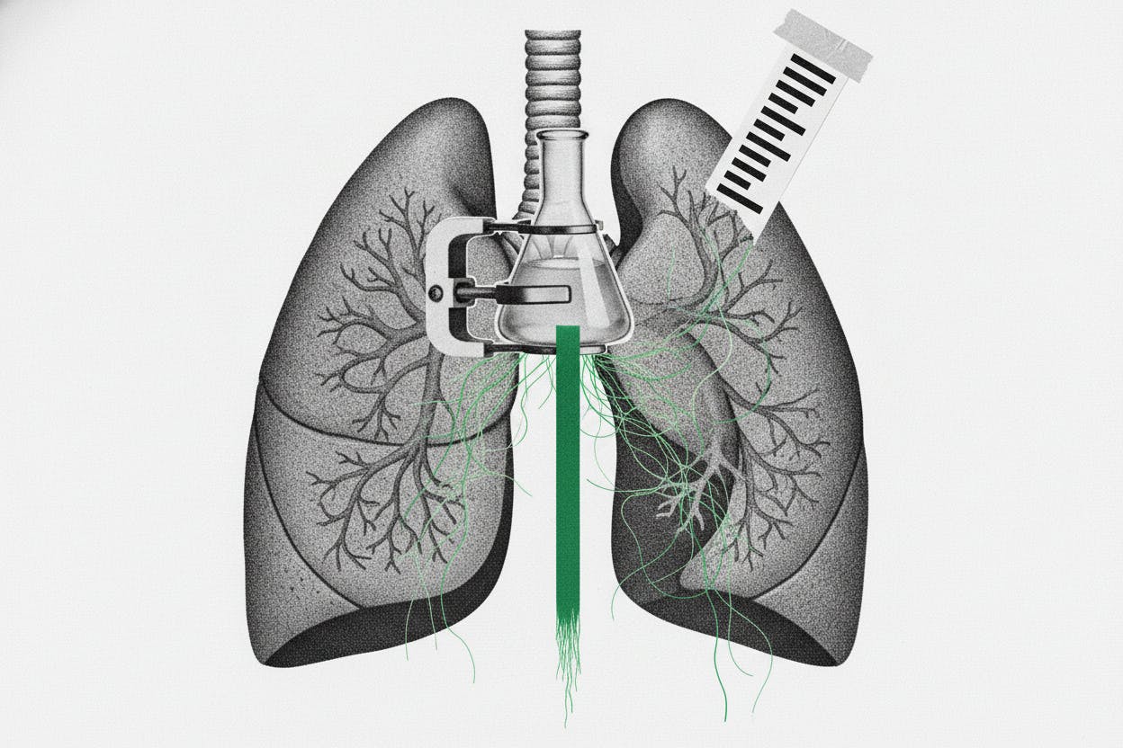 Zymeworks Buys Theravance for $929M to Enter COPD Market with Yupelri
